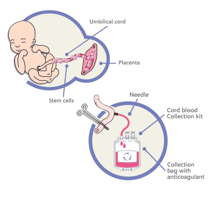 research studies on cord blood banking